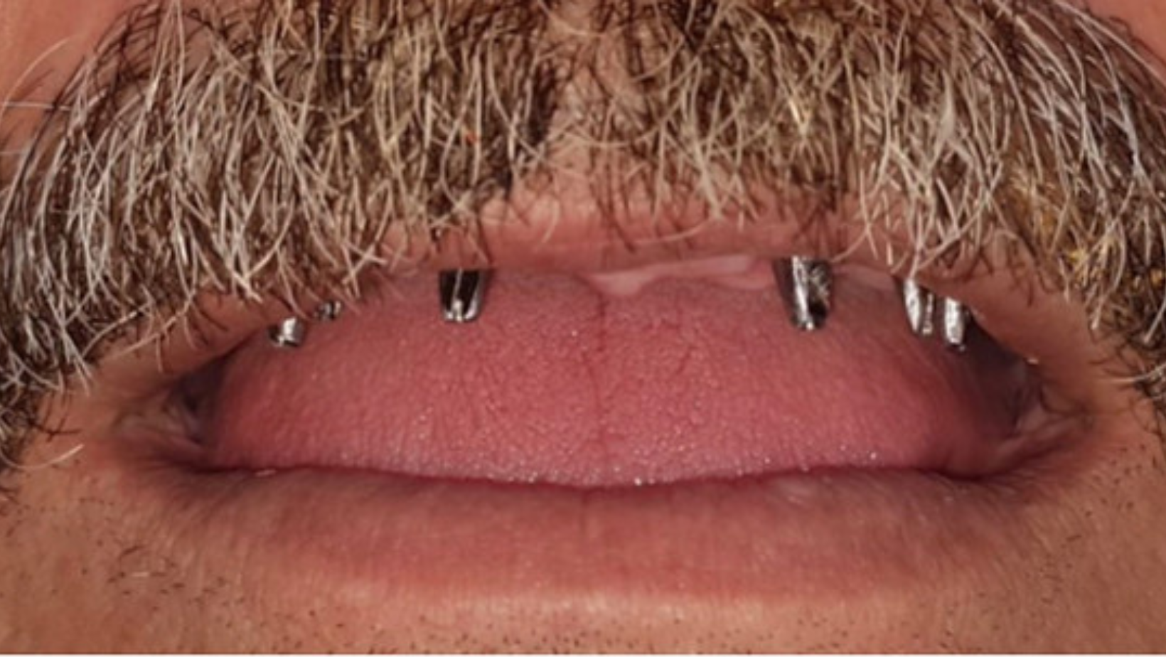 2Untitled design 2Untitled design