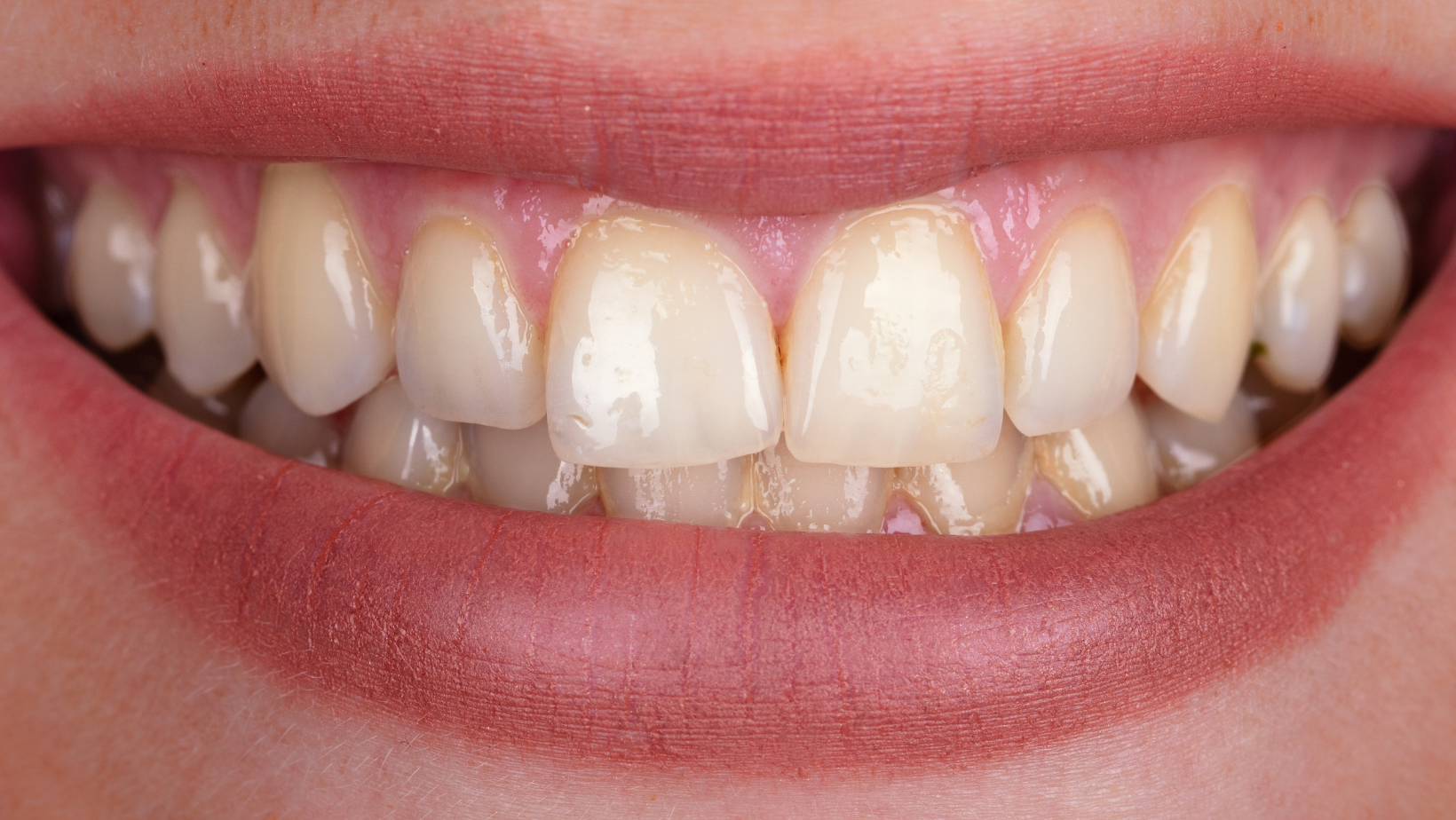 home whitening design home whitening design